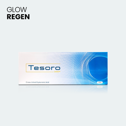 Tesoro Deep